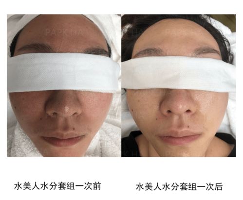 皮膚管理與生活美容 專業(yè)差異與生活服務(wù)